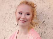 Jadi Model dengan Down Syndrome Pertama, Begini Transformasi Madeline Stuart