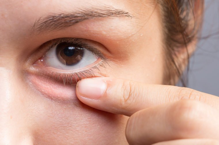 Hati-hati para Perempuan, Ini 3 Risiko yang Bisa Terjadi Akibat 'Eyelash Extension'