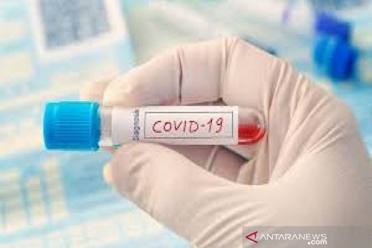 Seorang tenaga medis saat memperlihatkan sebuah alat laboratorium swab test. (Foto ANTARA/Azis Senong)