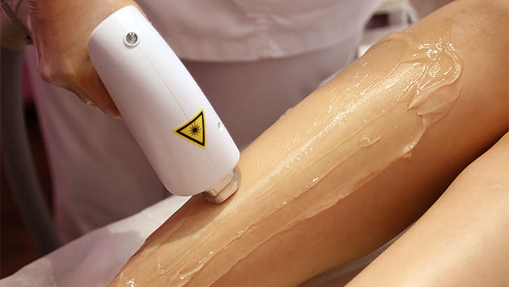 Ladies, Ketahui Risiko Menghilangkan Bulu dengan Laser