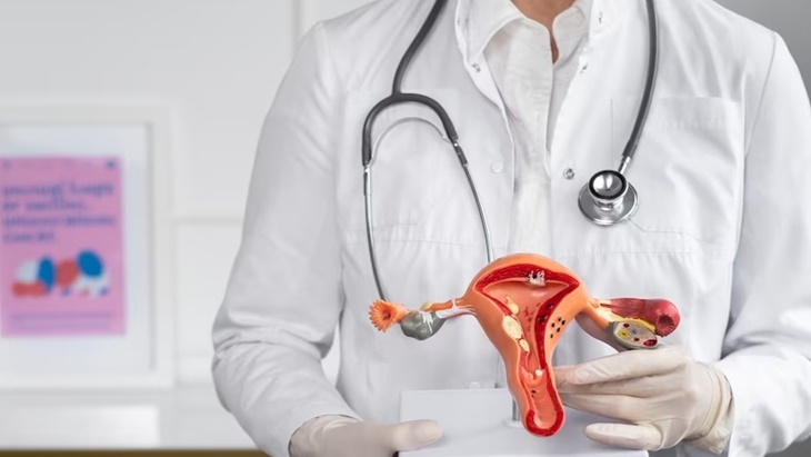 Histerektomi Bantu Perempuan dengan Kanker Serviks