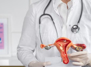 Histerektomi Bantu Perempuan dengan Kanker Serviks