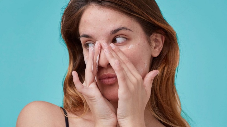 Skincare probiotik dikatakan mampu meredakan jerawat. (Foto- Healthline)