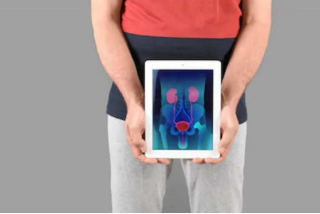 Ilustrasi seseorang terkena kanker prostat (Shutterstock) 