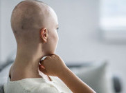 Tidak Perlu Takut Rambut Rontok Karena Kemoterapi