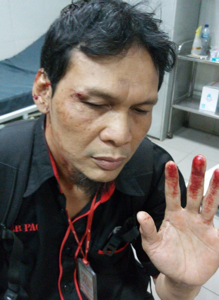 Seorang wartawan babak belur dipukul polisi dalam aksi unjuk rasa di Jakarta