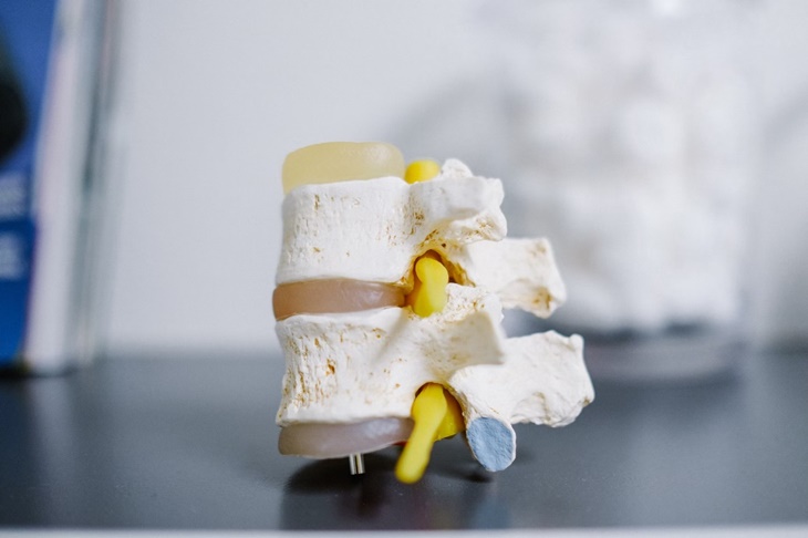 3 Langkah untuk Cegah Osteoporosis