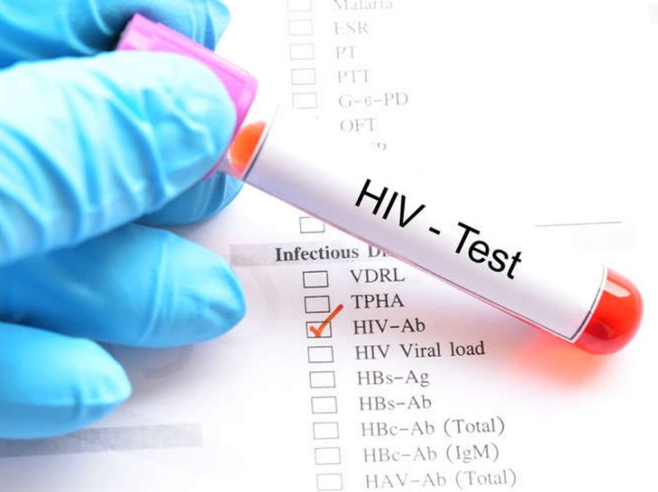 Kasus HIV Global Meningkat, Lindungi Diri