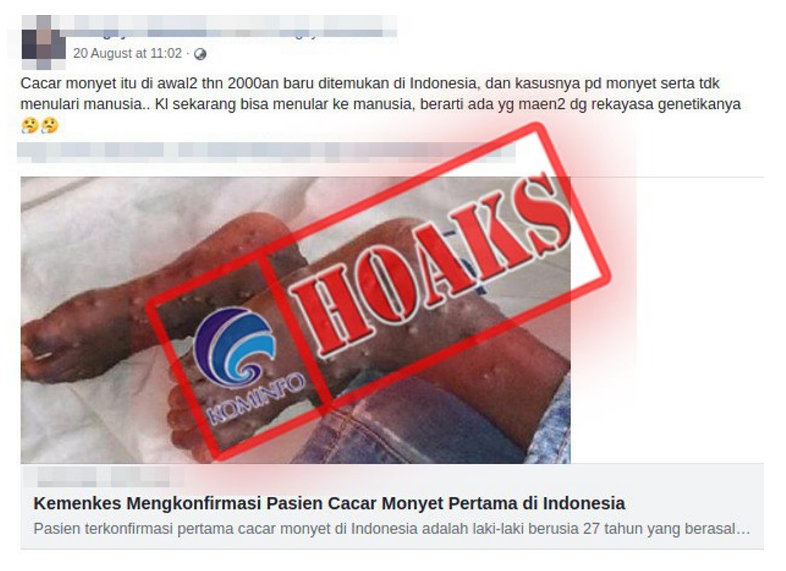 [HOAKS atau FAKTA]: Cacar Monyet Menular pada Manusia Akibat Rekayasa Genetika