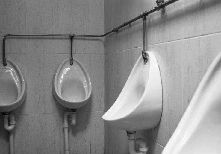 5 Penyebab Keruh pada Warna Urine