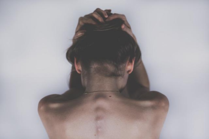 Mengenal Hair-Pulling Disorder, Gangguan Psikologis saat Alami Stres