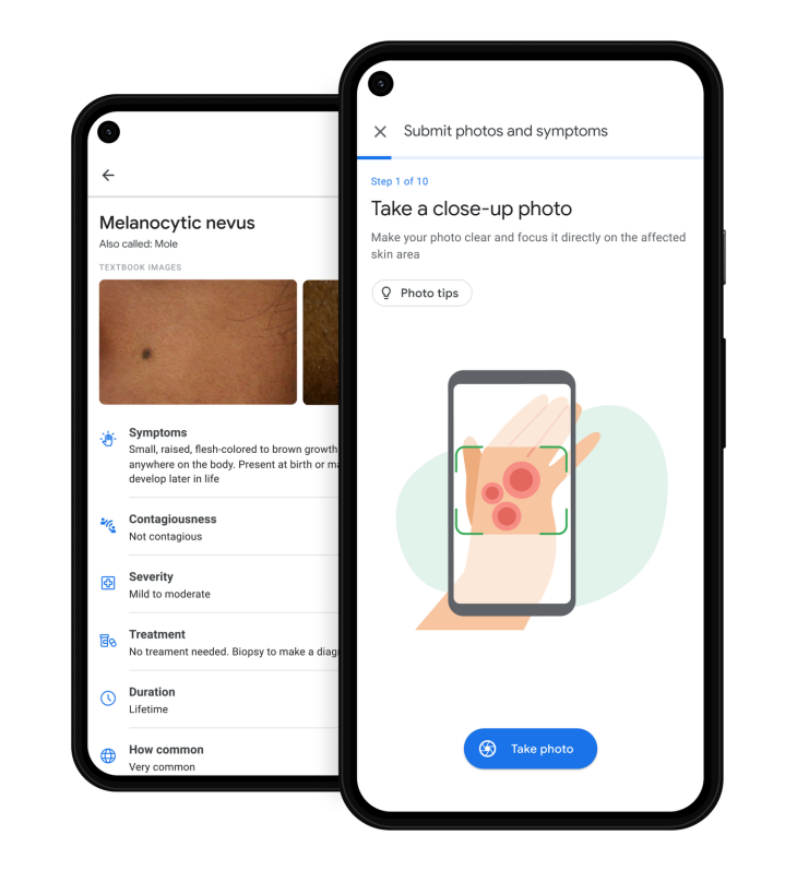 Google Hadirkan Health Tool untuk Identifikasi Kondisi Kulit