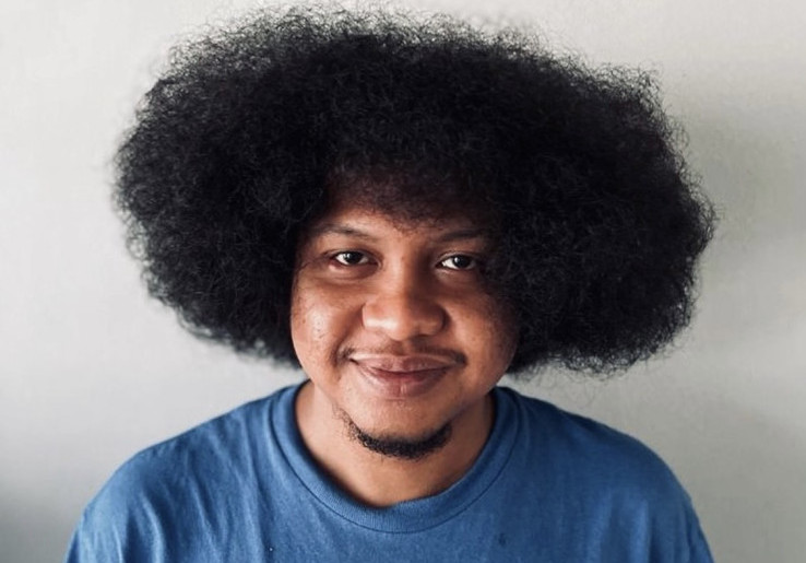Mengenal Anemia Aplastik, Penyakit Langka Babe Cabita