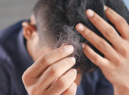 Segudang Manfaat Tea Tree Oil untuk Rambut