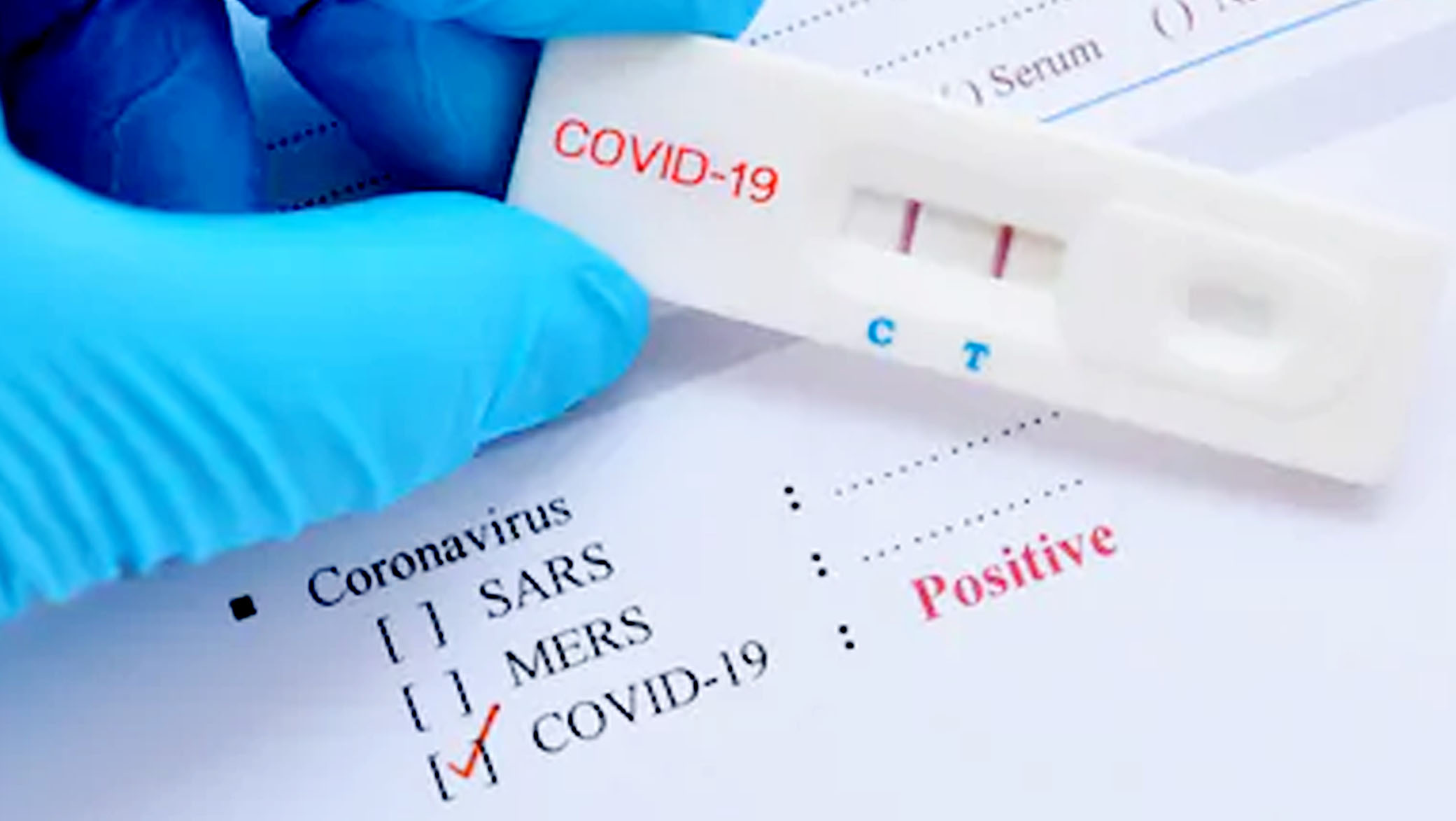 Update COVID-19: Bertambah 1.051, Kasus Corona di Indonesia Jadi 47.896