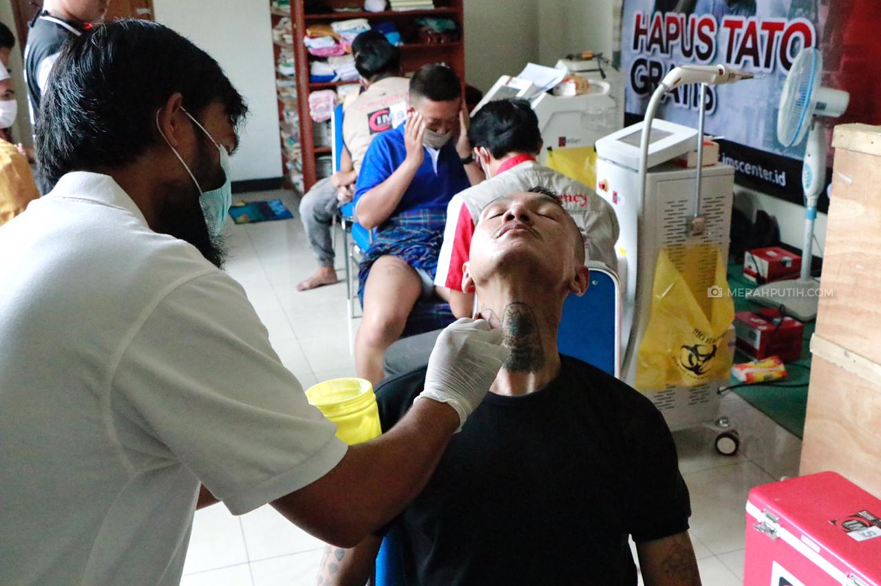 Gandeng IMS, Baznas DKI Selenggarakan Layanan Hapus Tato Gratis