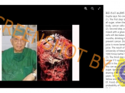 [HOAKS atau FAKTA]: Konsumsi Minyak Kelapa dan Air Lemon Bisa Sembuhkan Kanker