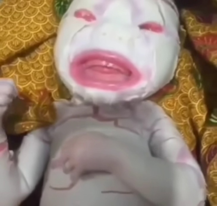 sakit