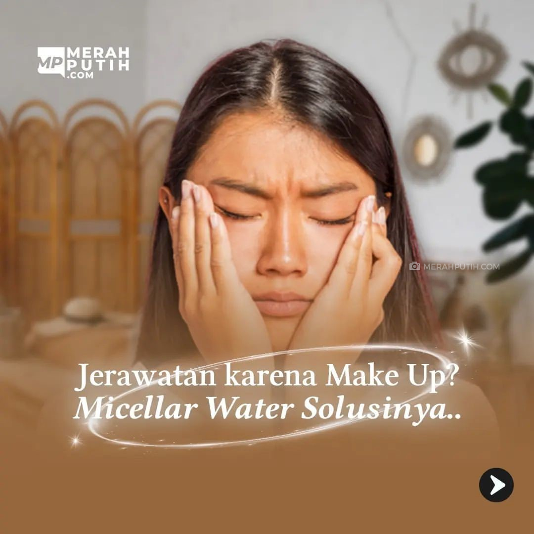 Jerawatan karena Make Up Micellar Water Solusinya