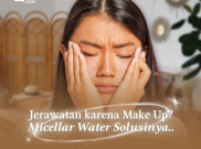 Jerawatan karena Make Up Micellar Water Solusinya