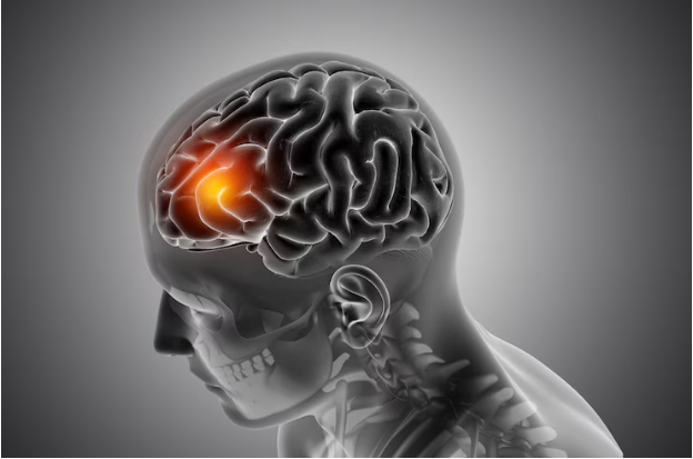 Apa Itu Brain Rot? Penyebab, Dampak, dan Cara Mengatasinya