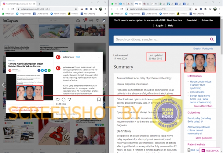 Tangkapan layar Instagram terkait kelumpuhan wajah akibat vaksin COVID-19. (Foto: MP/Turnbackhoax.id)