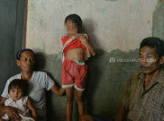 Bocah Tanpa Anus Butuh Uang Rp 50 Juta untuk Operasi