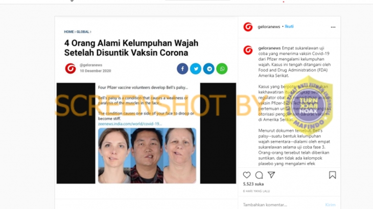 [HOAKS atau FAKTA]: Empat Orang Alami Kelumpuhan Wajah Setelah Disuntik Vaksin Corona