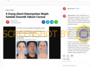 [HOAKS atau FAKTA]: Empat Orang Alami Kelumpuhan Wajah Setelah Disuntik Vaksin Corona