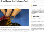 [HOAKS atau FAKTA]: Boba Menyangkut di Usus Buntu hingga Tak Bisa Dicerna