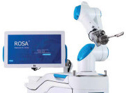 Teknologi Bedah Robotik Memungkinkan Tindakan Presisi untuk Kenyamanan Pasien, kini Hadir di Siloam Hospitals Kebon Jeruk