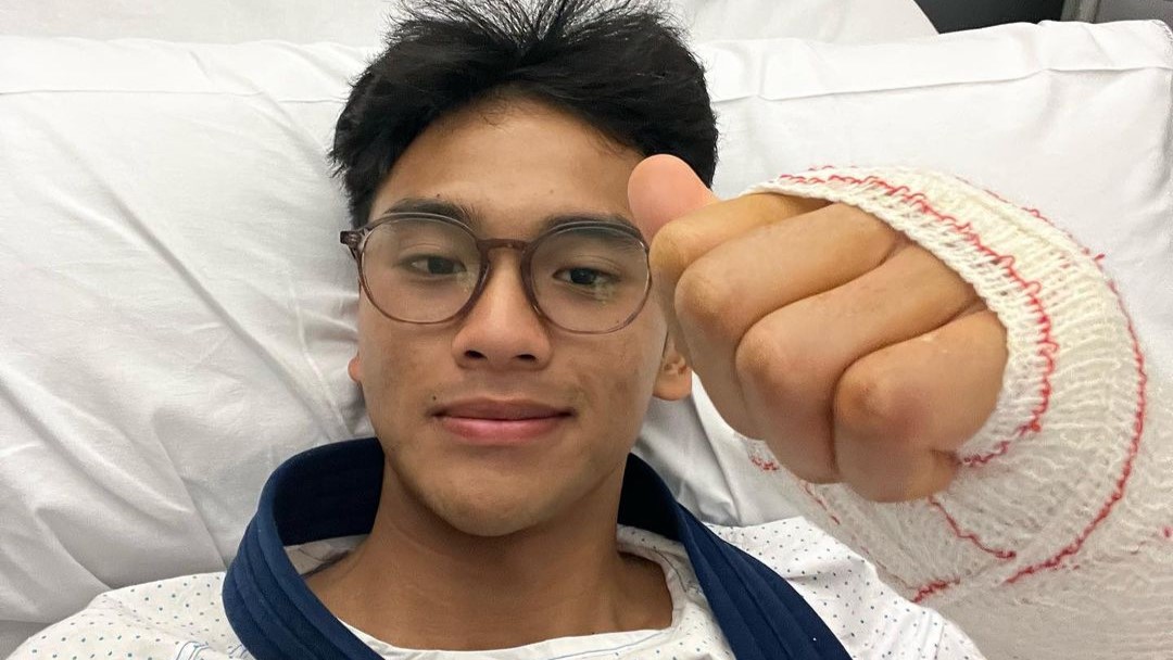 Mario Aji Jalani Operasi Lengan Kanan, Absen dari Moto2 Prancis 2024