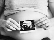 Segala Hal Mengenai Bayi Tabung yang Perlu Kamu Ketahui