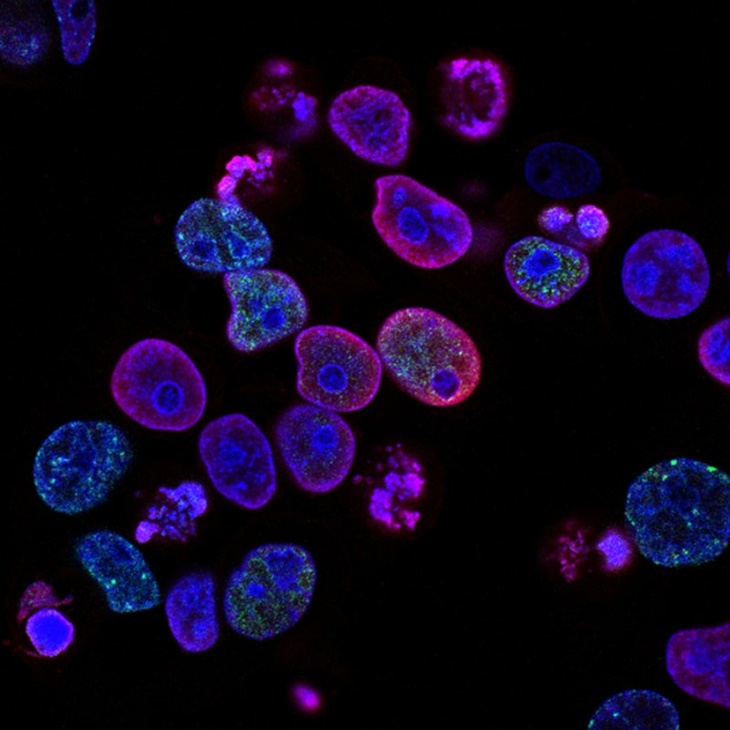 Kanker tidak selalu mematikan.  (Foto- Unsplash/National Cancer Institute)