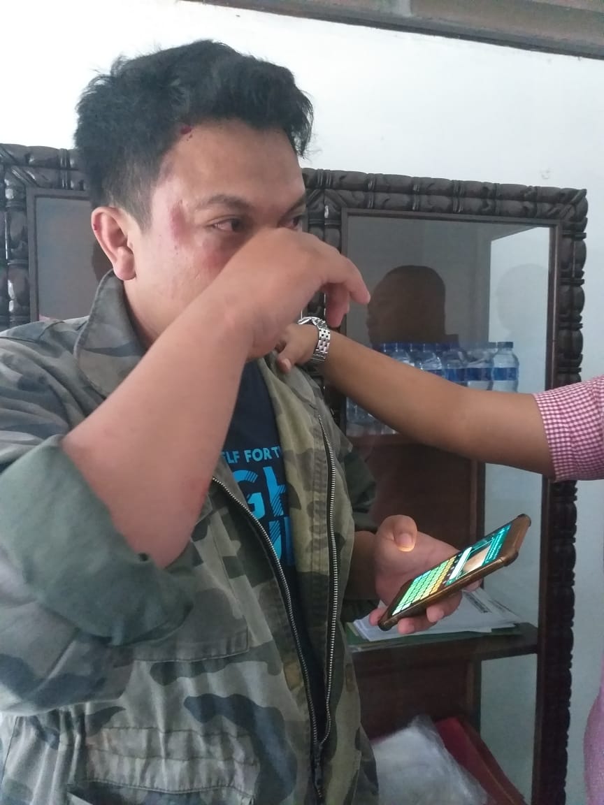 Muhammad Saiful Hadi, wartawan media lokal Sukabumi yang dipukuli Ketua dan Pengurus DPC Gerindra. (Ist)