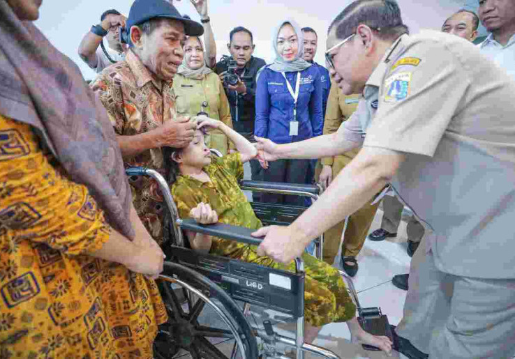55 Pasien dari Berbagai Daerah Jalani Operasi Bibir Sumbing di RSUD Kalideres