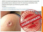 [HOAKS atau FAKTA]: Titik Suntikan Vaksin Sebabkan Tumor