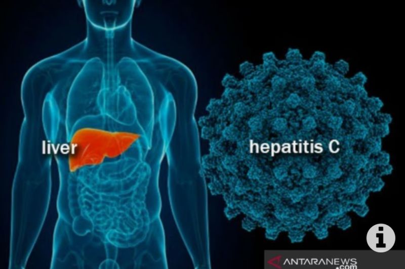 Ilustrasi hepatitis. (Foto: Antara)