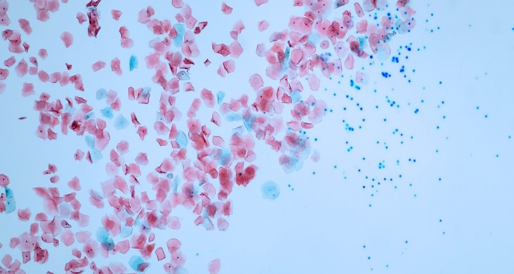 Mikroplastik dan Nanoplastik Ada di Tubuh Manusia?