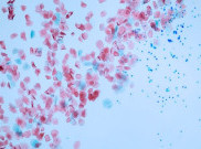 Mikroplastik dan Nanoplastik Ada di Tubuh Manusia?