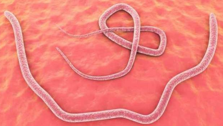 Heboh! Seorang Pria Tiba-Tiba Epilepsi Karena Cacing Hidup Di Bagian Tubuh Ini