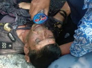 Anggota Polres Cianjur yang Terbakar Saat Demo Mahasiswa Dikabarkan Meninggal Dunia