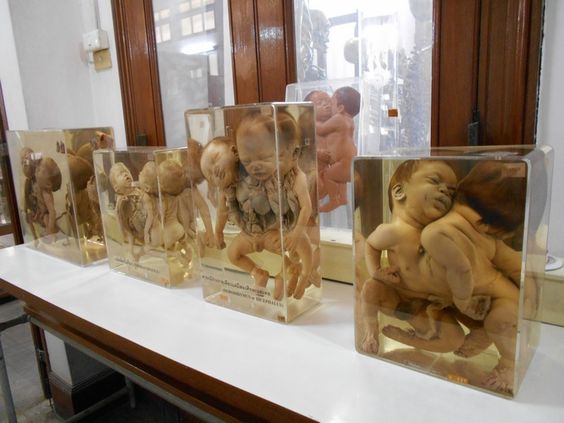 Mengisi Waktu Liburan ke Museum Paling Unik di Dunia