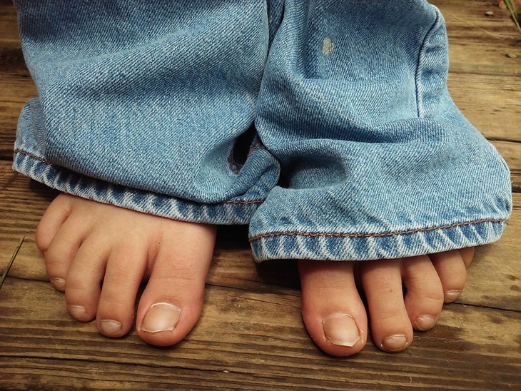 Kesalahan memotong kuku kaki bisa menimbulkan infeksi. (Foto: Pixabay/RedbudPatriot)