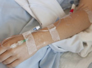 Menghilangkan Bengkak Setelah Infus