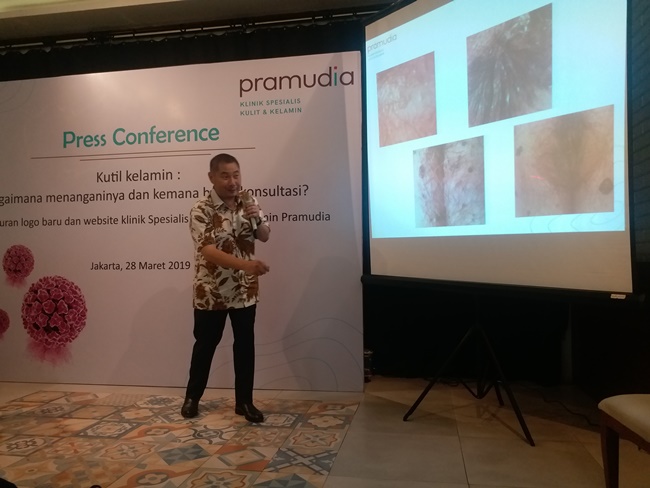 Kutil Kelamin