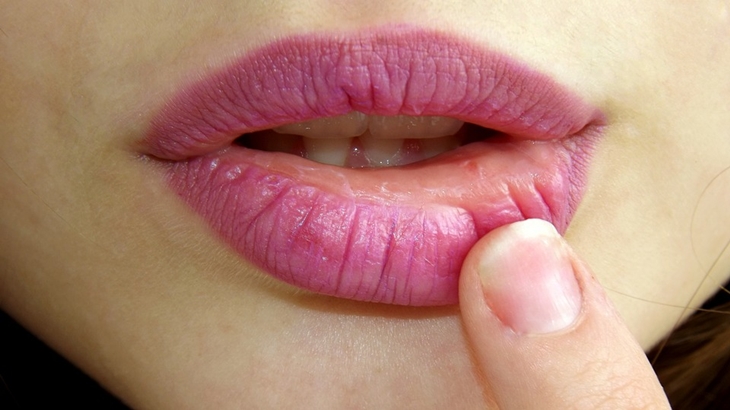 Kamu bisa gunakan masker bibir sebelum tidur. (Foto: Pixabay/AdinaVoicu)
