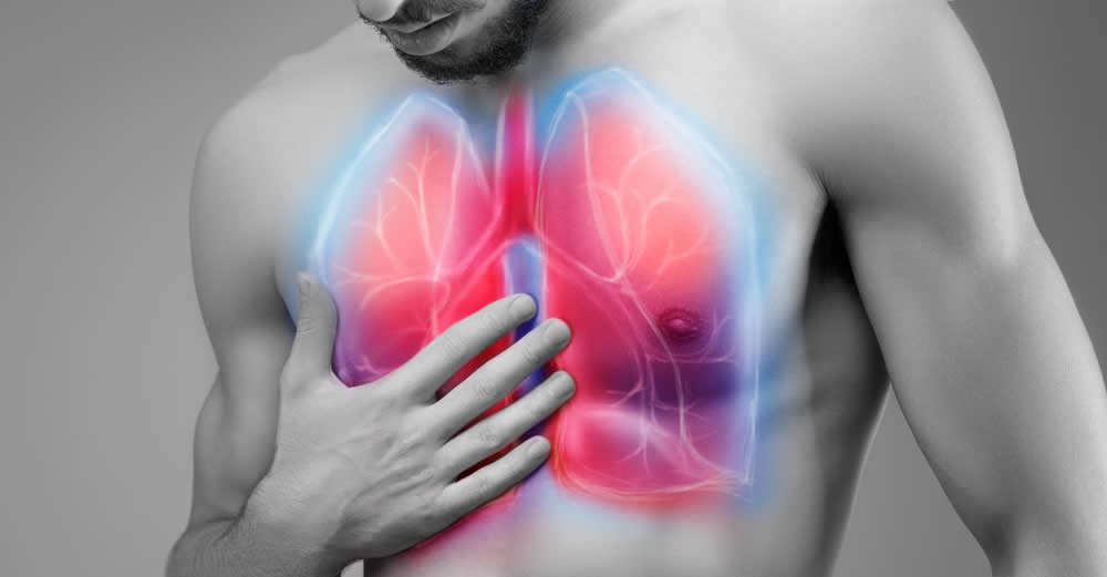 Hipertensi paru sering terjadi pada perempuan (Sumber: Expand a Lung)