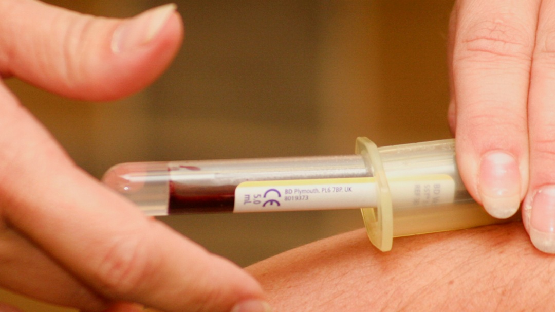 Berbeda dengan Anemia, Ketahui Definisi Thalasemia dan Berbagai Jenisnya