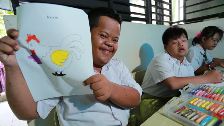 Anak penderita Down Syndrome (MP/Rizki Fitrianto)